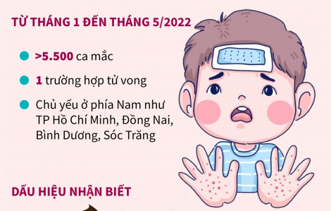 Hơn 5.500 ca mắc tay chân miệng từ đầu năm 2022, Bộ Y tế cảnh báo dịch gia tăng