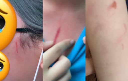 Bộ GD-ĐT chỉ đạo xử lý nghiêm vụ phụ huynh tố con bị đánh ở trường quốc tế