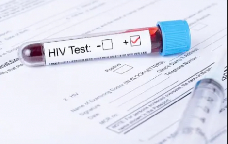 Nhiễm HIV làm tăng 38% nguy cơ tử vong khi mắc COVID-19