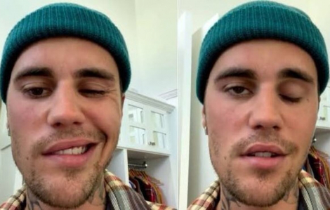 Bệnh hiếm mà Justin Bieber mắc phải cụ thể nguy hiểm ra sao?