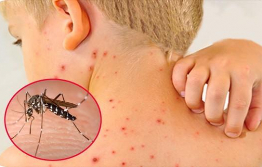 TPHCM đẩy mạnh phòng, chống sốt xuất huyết trong trường học