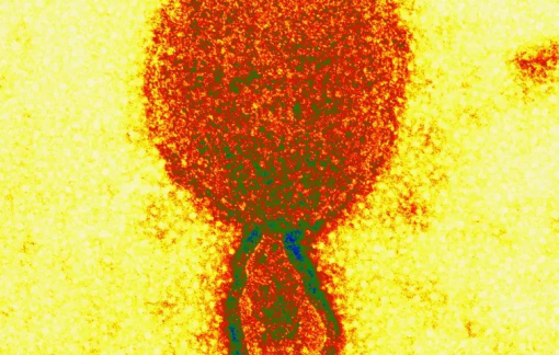 Phát hiện virus mới ở Trung Quốc có khả năng gây chết người