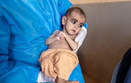 Trẻ em chết đói ở Afghanistan