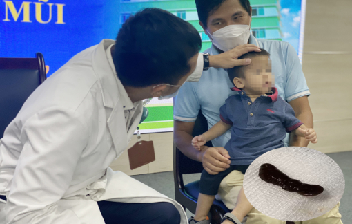 Bé trai bị vắt chui vào mũi suốt 10 ngày