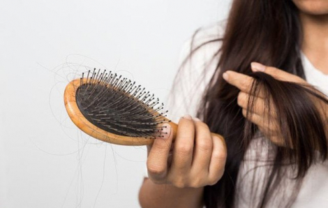 Bệnh nhân COVID-19 có thể rụng 1.000 sợi tóc mỗi ngày