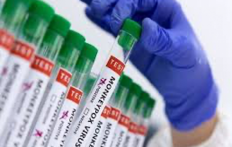 Khan hiếm vắc xin đậu mùa khỉ, Tây Ban Nha cho phép chia nhỏ liều tiêm