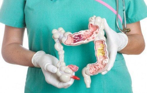 Một đại dịch toàn cầu về ung thư ở những người dưới 50 tuổi đang nổi lên