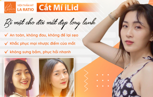 Cắt mí iLid - Bí mật cho đôi mắt đẹp long lanh