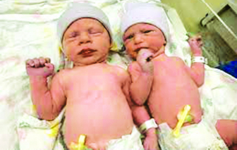Cặp song sinh ra đời từ phôi thai đông lạnh 30 năm