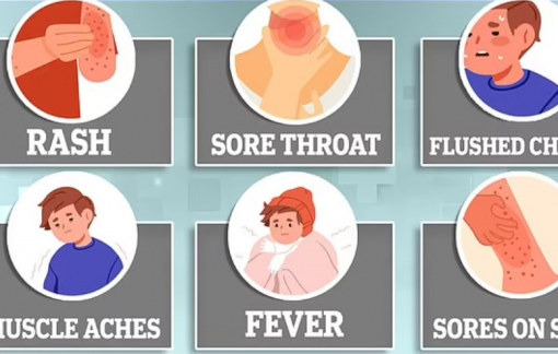 WHO kêu gọi thận trọng với nhiễm trùng liên cầu khuẩn A khiến nhiều trẻ tử vong