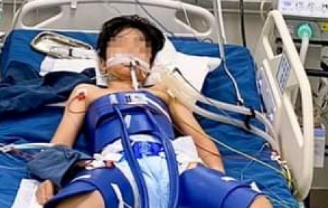 Bé trai ngừng tim hơn 1 tiếng sau khi gặp tai nạn chơi bóng đá