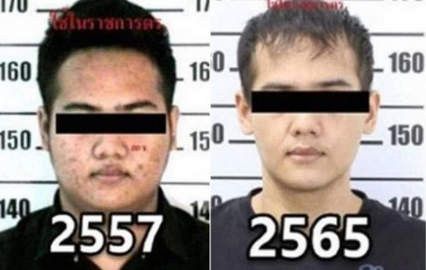 Phẫu thuật nhiều lần để thay hình đổi dạng, trùm ma túy Thái Lan vẫn bị tóm