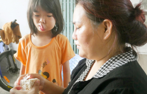 Mong con được phẫu thuật để lấy lại tự tin