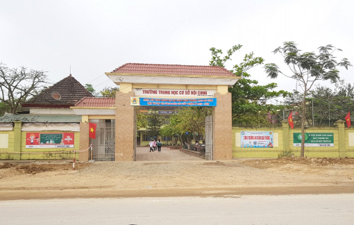 Đùa vui lúc ra chơi, nam sinh lớp 7 bị bạn đánh lõm đầu