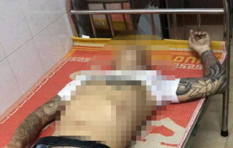 Khánh Hòa: Điều tra vụ nổ súng làm 1 người tử vong