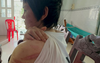 Vụ thai phụ bị chồng bạo hành dã man: Hội LHPN tỉnh Hải Dương đề nghị UBND huyện Kim Thành bảo vệ nạn nhân