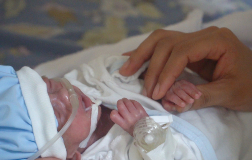 Bé trai sinh non chân chỉ bằng ngón tay út của bác sĩ