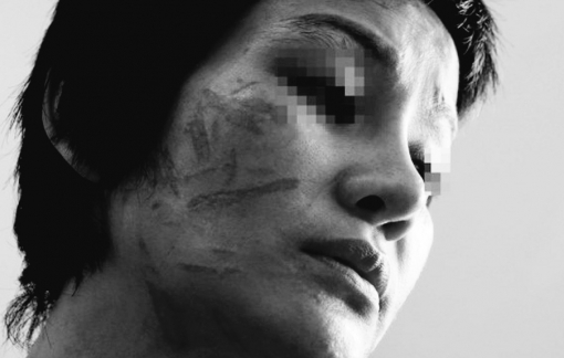 Vụ vợ mang bầu 7 tháng bị bạo hành dã man: Chồng doạ giết cả gia đình