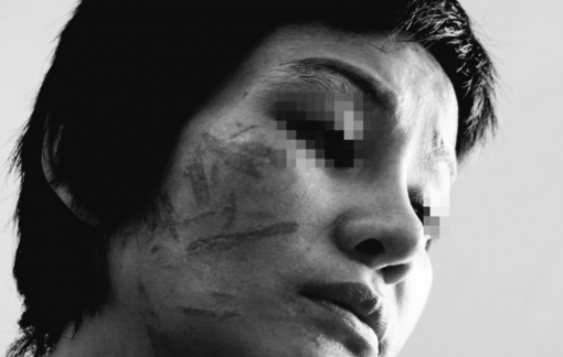 Bắt giam người chồng đánh đập dã man vợ mang bầu 7 tháng