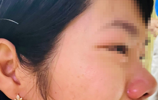 Đề nghị khẩn trương điều tra vụ cô giáo bị phụ huynh đến nhà hành hung