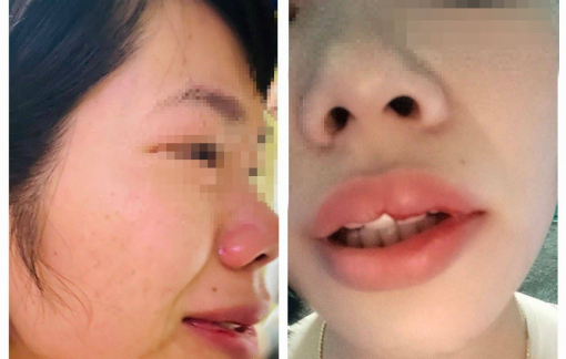 Xử phạt phụ huynh xông đến nhà hành hung cô giáo vì con bị hạnh kiểm trung bình