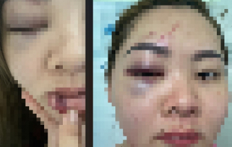 Kỷ luật thầy giáo đánh vợ nhập viện