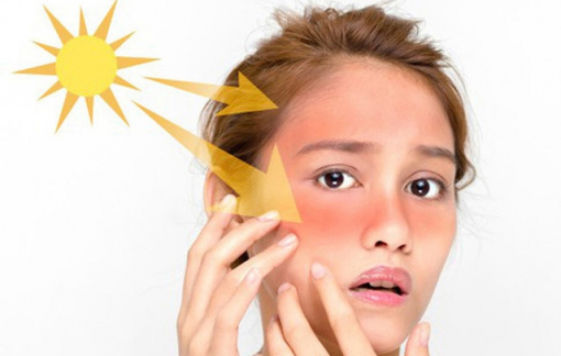 Đã đến lúc không được chủ quan với ánh nắng