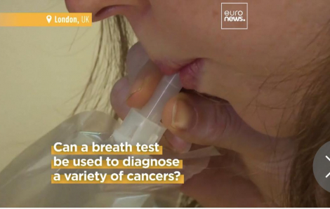 Thử nghiệm kiểm tra hơi thở để phát hiện ung thư sớm