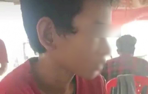 An Giang: Bé trai bị cha dượng dùng bật lửa đốt vùng kín