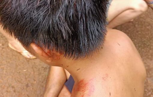 Bình Phước: kiểm tra, xác minh vụ clip "công an đánh dân"