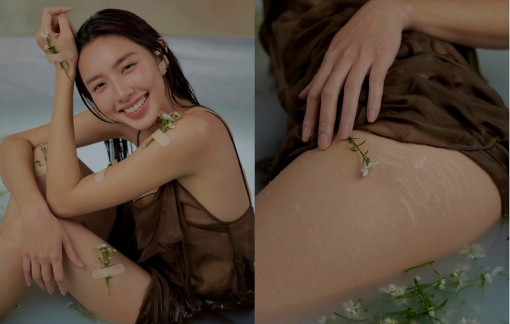 Hoa hậu Thùy Tiên khoe vết rạn da, cổ vũ phái nữ tự tin là chính mình