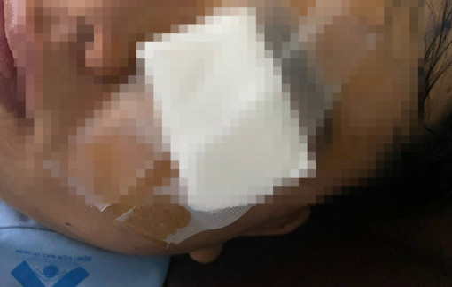 Công an TPHCM thông tin vụ thanh niên tố CSGT dùng gậy đánh vào mắt