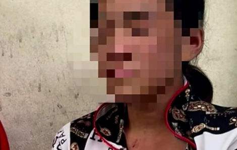 Tạm giữ người đàn bà hành hạ thiếu nữ 16 tuổi ở Cà Mau
