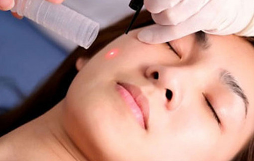 Thẩm mỹ viện SeoulSpa.Vn - Địa chỉ tẩy nốt ruồi không sẹo, không đau, không tái lại