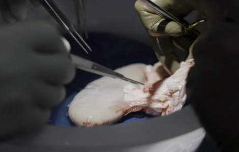 Thận lợn hoạt động kỷ lục 2 tháng trên cơ thể hiến tặng, nuôi hy vọng cấy ghép cho người