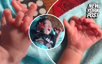 Bé gái sinh ra có 14 ngón tay và 12 ngón chân