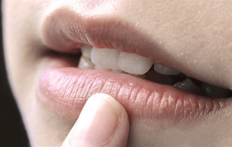 Làm sao khử thâm môi an toàn?