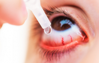 Xử lý nghiêm cơ sở tăng giá thuốc điều trị đau mắt đỏ