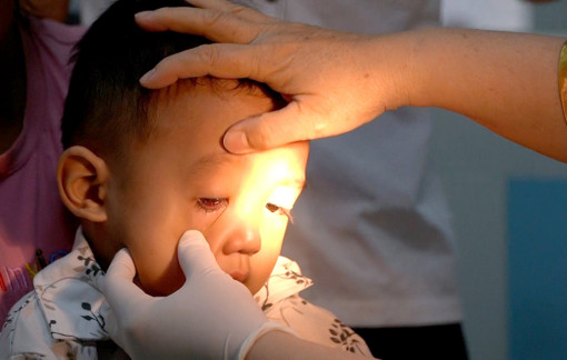 Dịch đau mắt đỏ tăng nhanh ở TPHCM