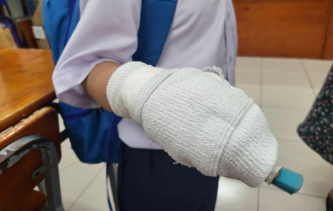 Học sinh bị gãy đốt ngón tay do cô giáo 'tác động': Trường nhận trách nhiệm, sẽ xử lý giáo viên