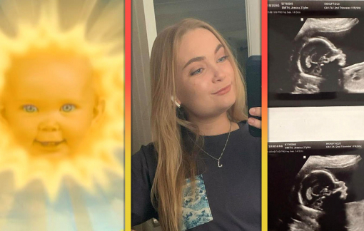 “Cô bé mặt trời” Teletubbies thông báo mang thai con gái