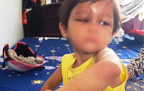 Bắt người đàn ông đánh đập con gái nuôi 4 tuổi ở Cà Mau
