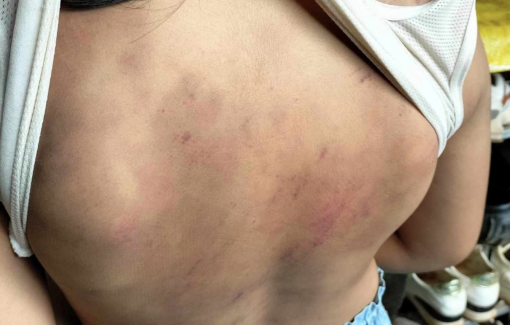 Vụ học sinh lớp 4 bị bạn đánh hội đồng: Huyện yêu cầu rà soát báo cáo