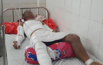 3 ngư dân ở Cà Mau bị thương do nổ hầm máy ghe lưới ghẹ