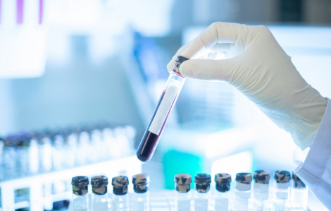 Xét nghiệm máu phát hiện sớm đa ung thư của Công ty Grail trên lộ trình xin cấp phép từ FDA