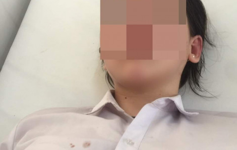 Nữ sinh lớp 11 bị đánh hội đồng gãy xương, nhập viện