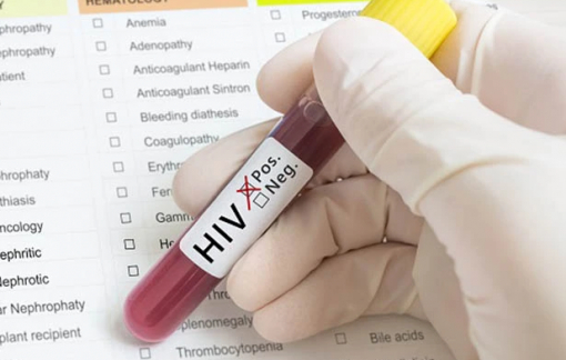 Người đàn ông nhiễm HIV đi tù vì nói dối để hiến máu
