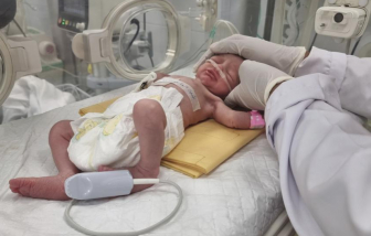 Em bé Palestine chào đời trong ca mổ lấy thai khẩn cấp khi người mẹ và cả gia đình đều chết vì bom đạn