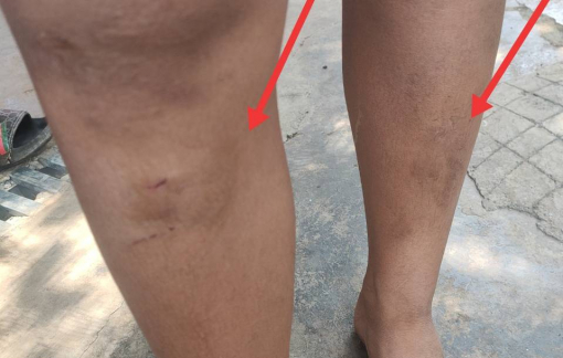 Chuyển hồ sơ vụ 5 cháu nhỏ bị đánh đập đến Công an TP Buôn Ma Thuột