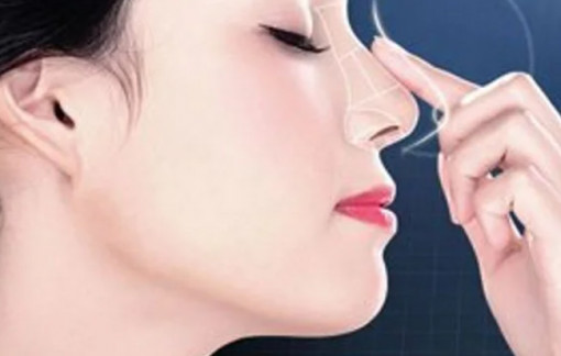 Băn khoăn nâng mũi bằng chỉ hay tiêm filler?